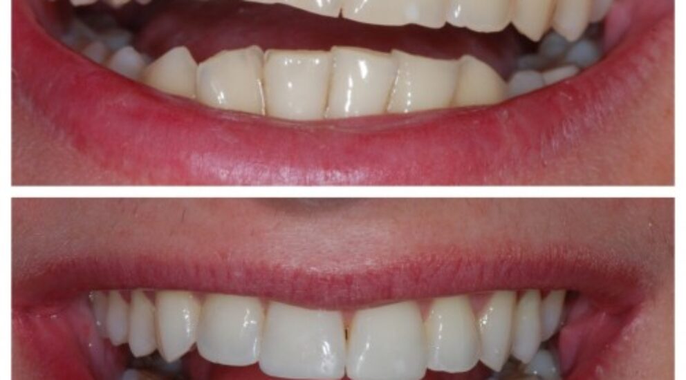 Blog -Sale Dental Spa