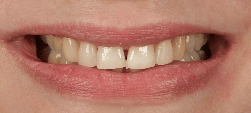 Before - saledental