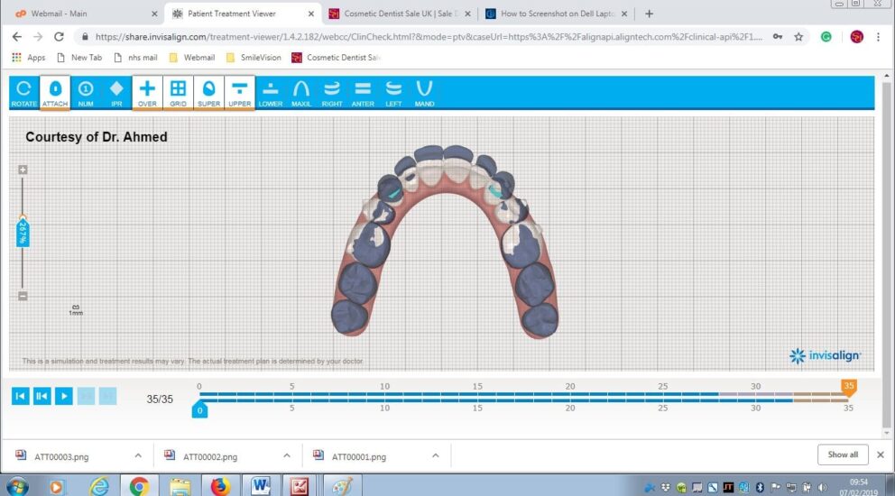 Blog -Sale Dental Spa
