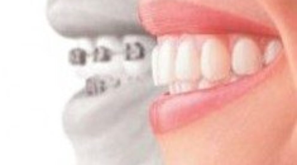 Blog -Sale Dental Spa