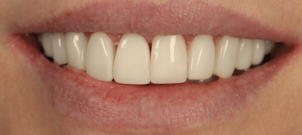 After - saledental