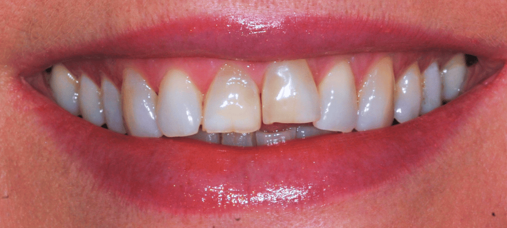 Before - saledental