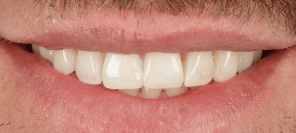 After - saledental
