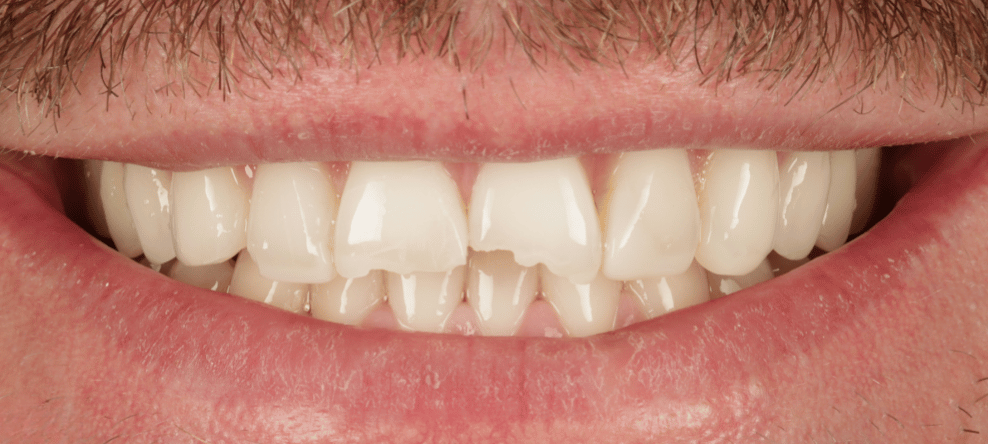 Before - saledental