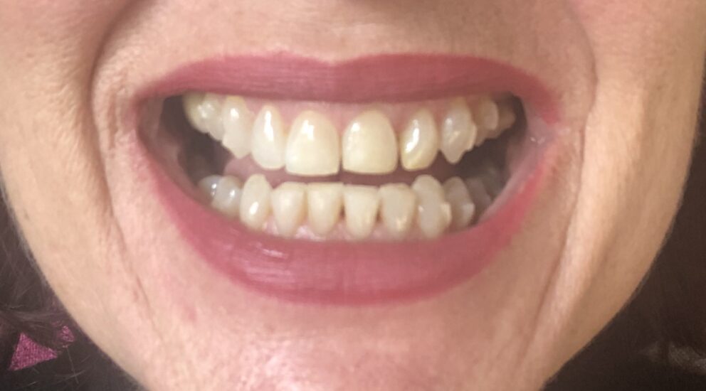 Blog -Sale Dental Spa