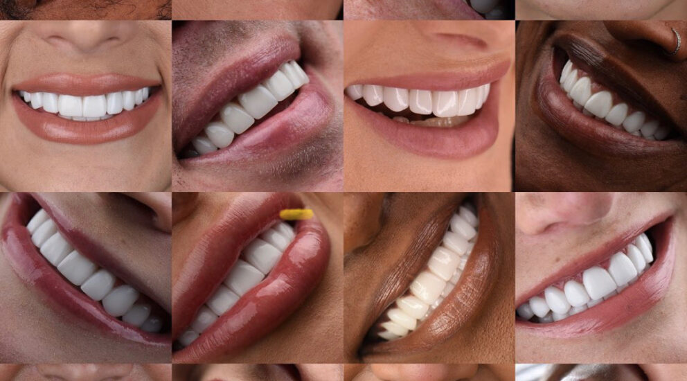 Blog -Sale Dental Spa